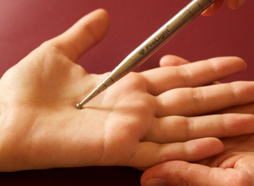 Meridian-behandlung-2